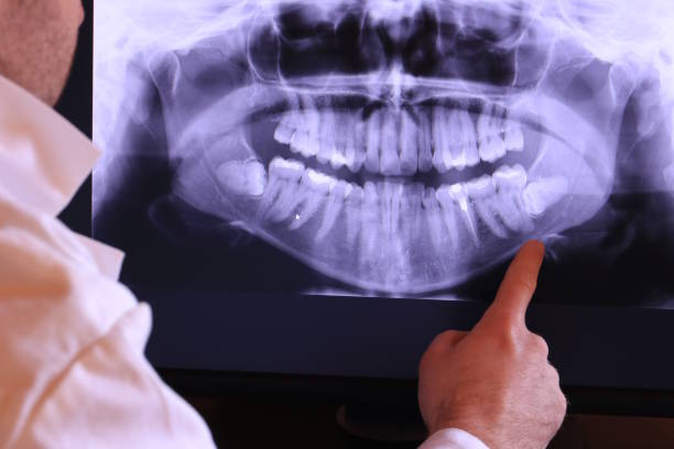 Best Emergency Dental Services for Seniors in Shavano Park, TX